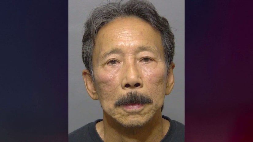 Florida man allegedly took a hammer to surgeon’s Tesla after doctor canceled the surgery because the suspect drank water