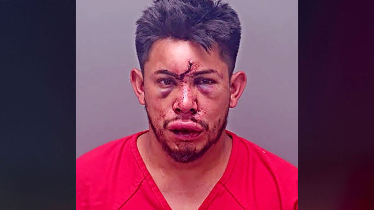 Un garçon de 13 ans assomme son père qui aurait tenté d’étrangler sa mère