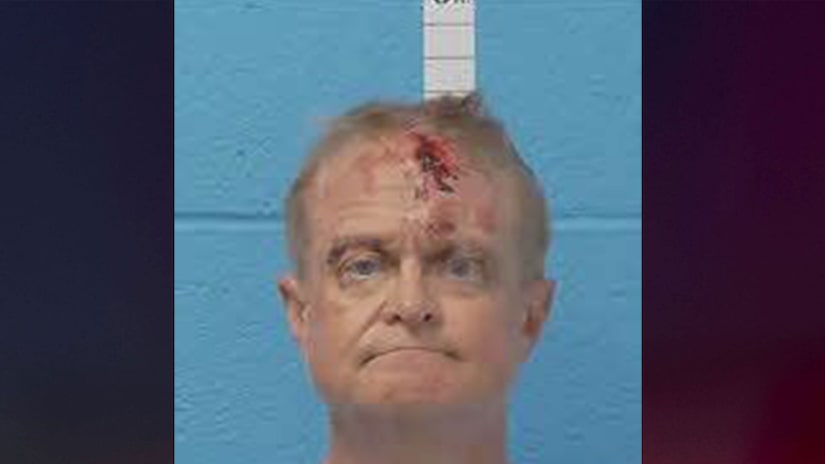 Pharmacist who allegedly tried to pull wife’s head off, shot her, and ate her remains told 911 dispatchers she was ‘dead as fried chicken’