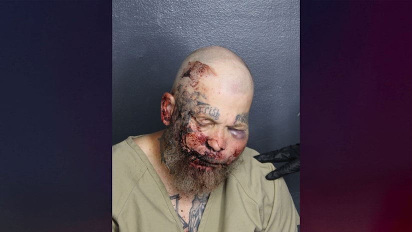 Florida man arrested after allegedly challenging cop to a fight inside hospital